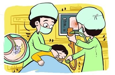 做胃鏡檢查要花多少錢(qián)