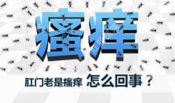 肛門(mén)瘙癢治不好嗎？先檢查病因就好辦！